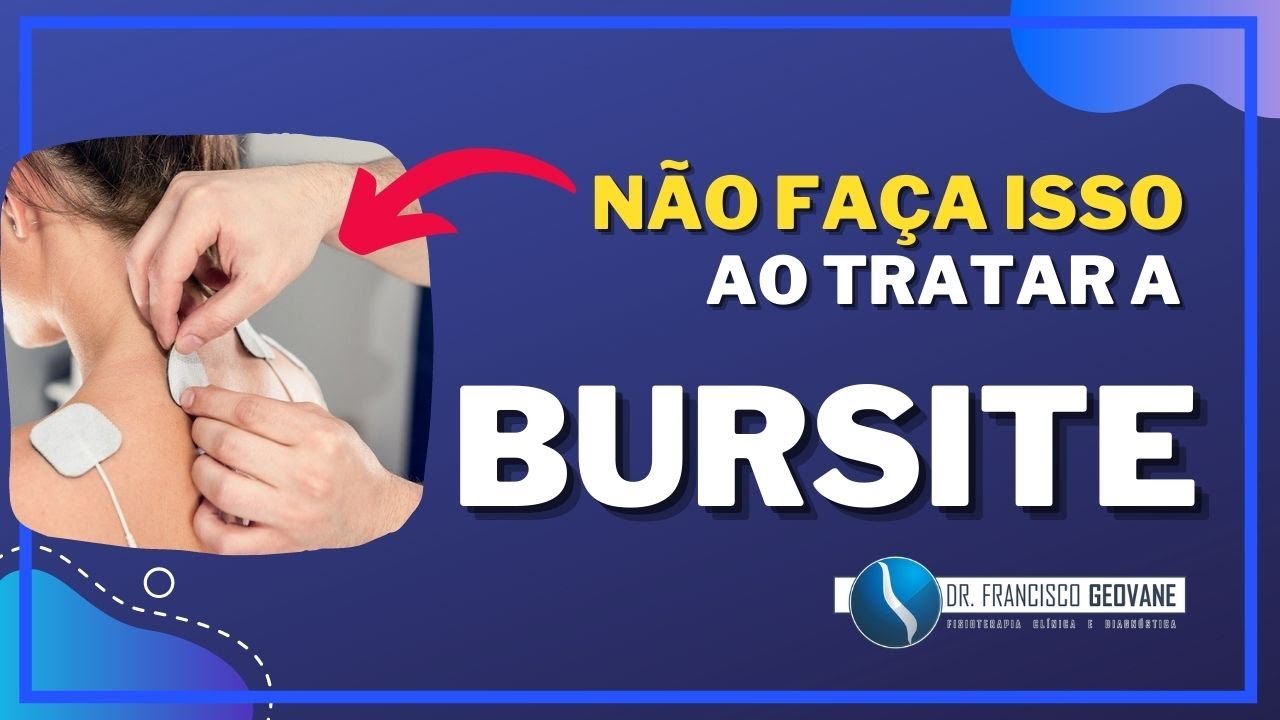 BURSITE SUBACROMIAL - 05 ERROS que TODO FISIOTERAPEUTA comete ao tratar a BURSITE DO OMBRO