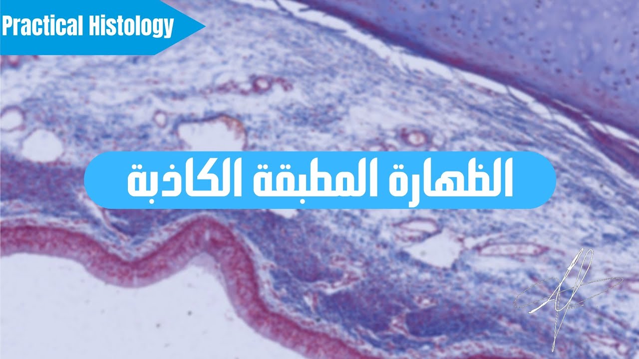 الظهارة البسيطة الخاصة ( المطبقة الكاذبة )