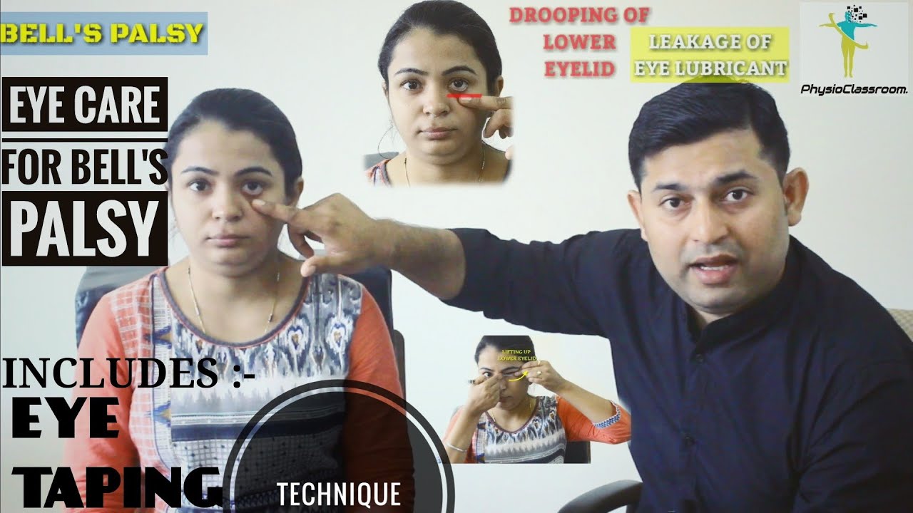 EYE CARE & EYE TAPING TECHNIQUE FOR BELL'S PALSY