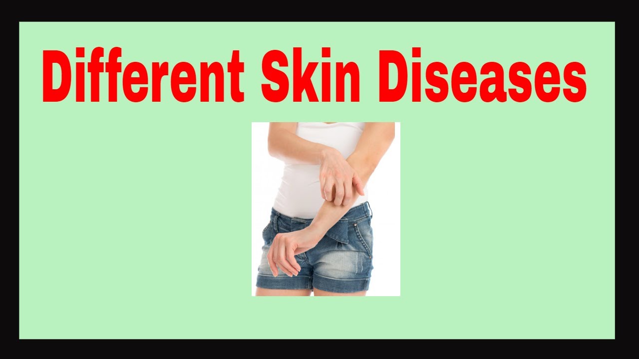What are the Different SKIN DISEASES 👍👍