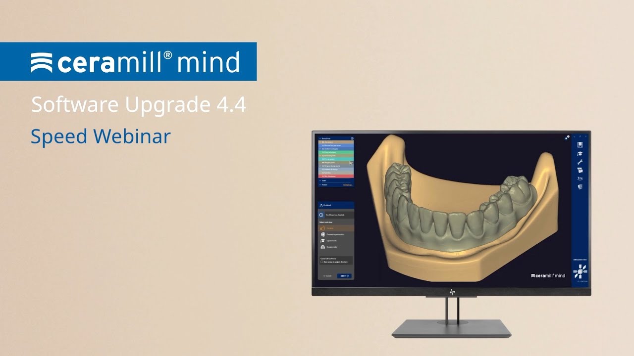Ceramill Software Upgrade 4.4 - Speed Webinar