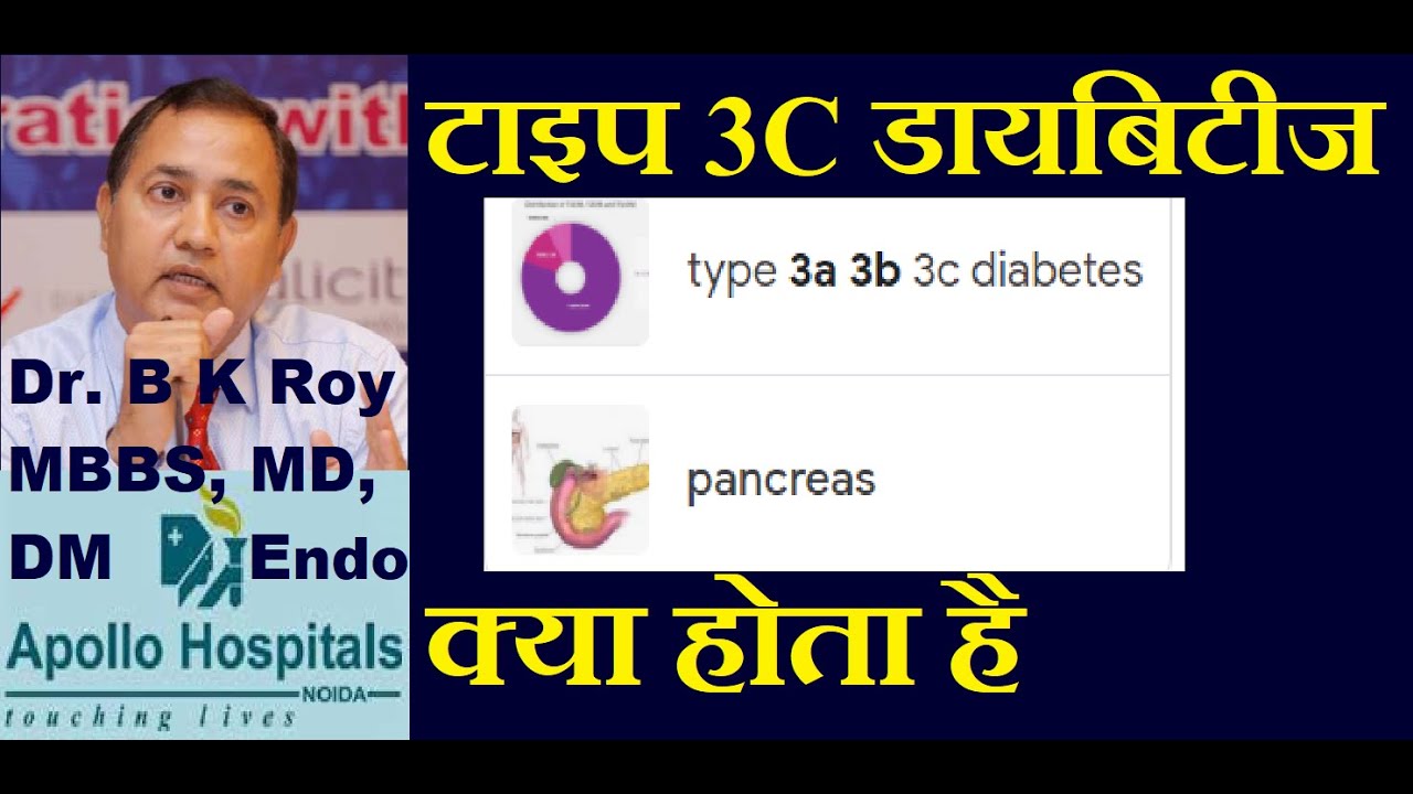 Type 3C Diabetes क्या होता है  a New Disease | टाइप 3 डायबिटीज क्या होता है | Endocrinoligist Noida
