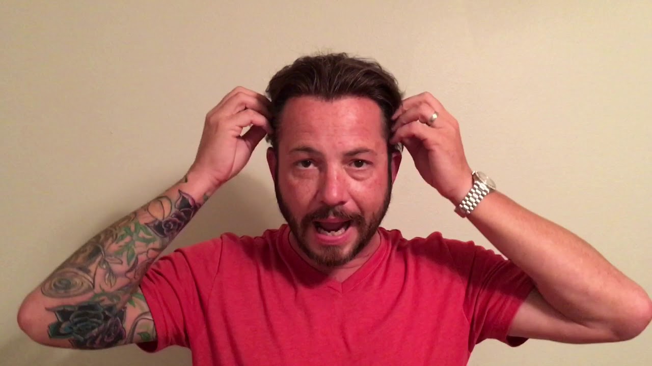 Density and Age, If its too thick It doesn't look real!! Hair Replacement and Hair System