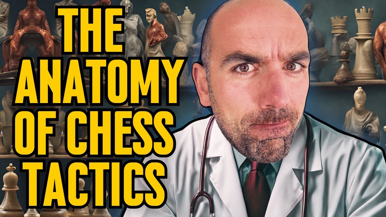 Master the Art of Removing the Defender (Chess Tactics Exposed)
