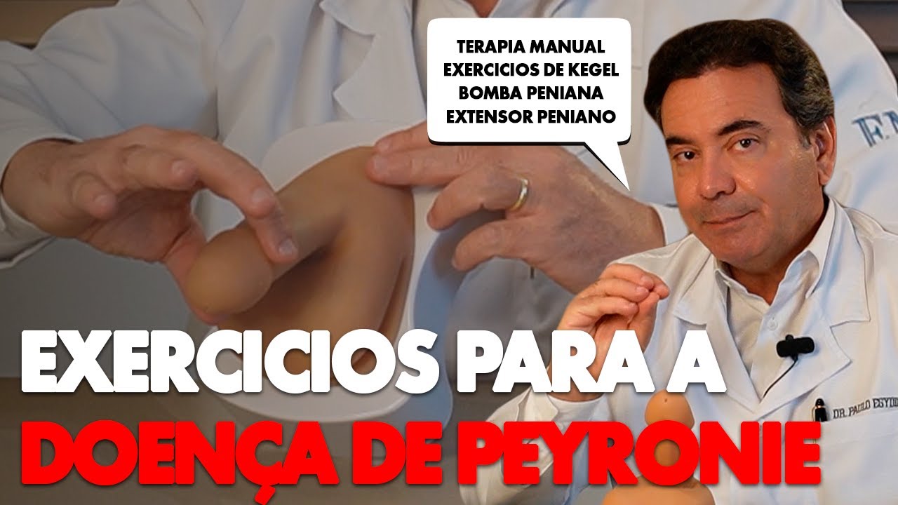 Exercícios para a Doença de Peyronie: Veja Como Fazer | Dr. Paulo Egydio