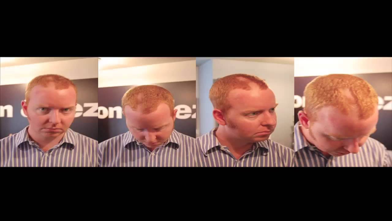 Ron & Fez - Dave's Haircut Prank (The Botched Threesome)