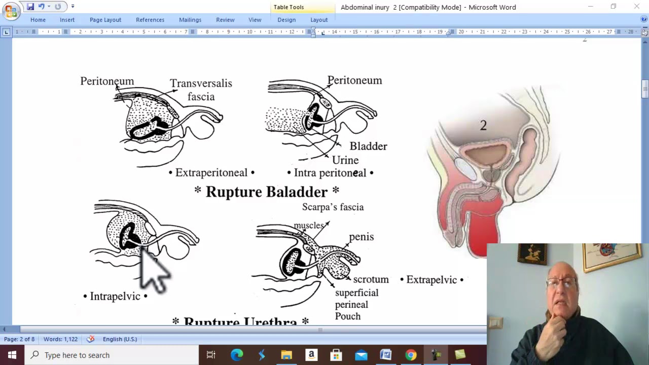 Trauma in Arabic 36 ( Extra-peritoneal Injury of Urinary Bladder ) , by Dr. Wahdan .