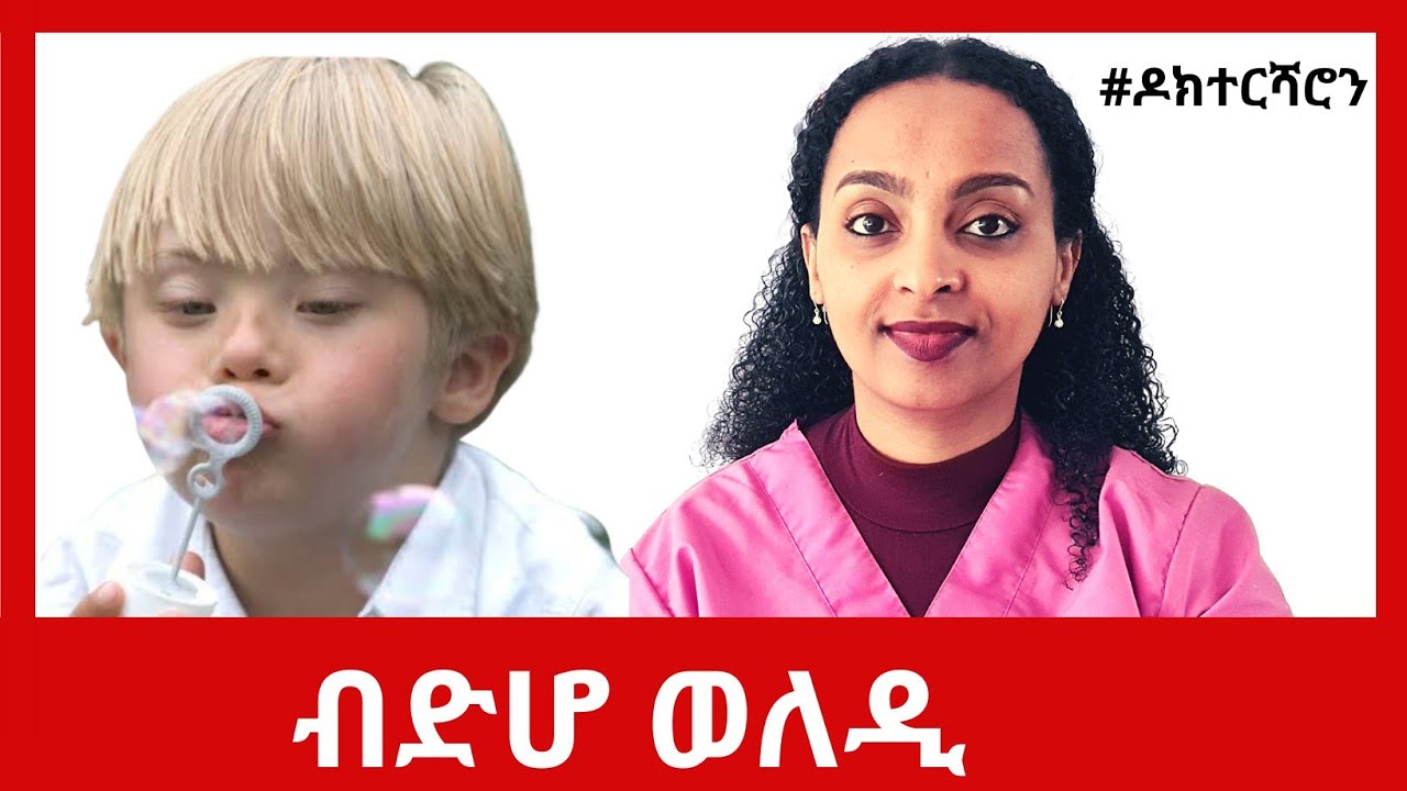 Down syndrome  - ዳውን ሲንድሮም ኣብ 8 ደቓይቕ #ዶክተርሻሮን