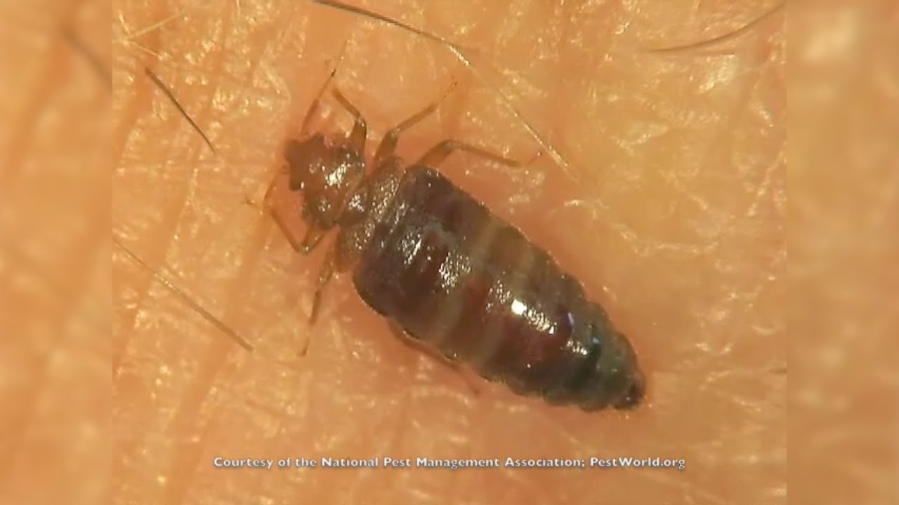 Here's Why Bed Bugs Are So Hard To Get Rid Of