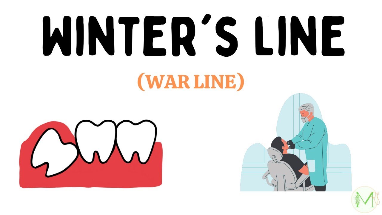 Winter's Line | War line | Impaction | Oral surgery | Medinare