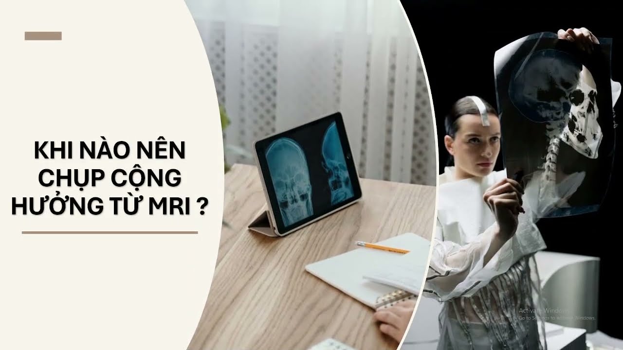 Chuyên đề Lí 12: Chụp ảnh cộng hưởng từ MRI