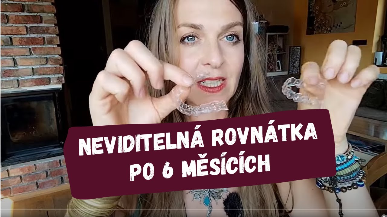 Neviditelná rovnátka 5.díl - po 6 měsících, bolestivost, broušení zubů