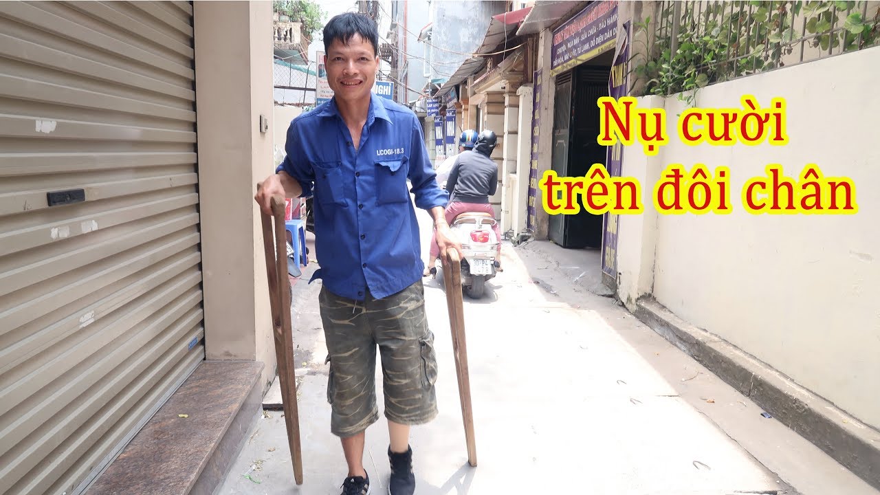 Lắp xong chân giả cho anh Thiên, nhà ngèo bị tai nạn cụt chân | Tình người (phần 2 hết )