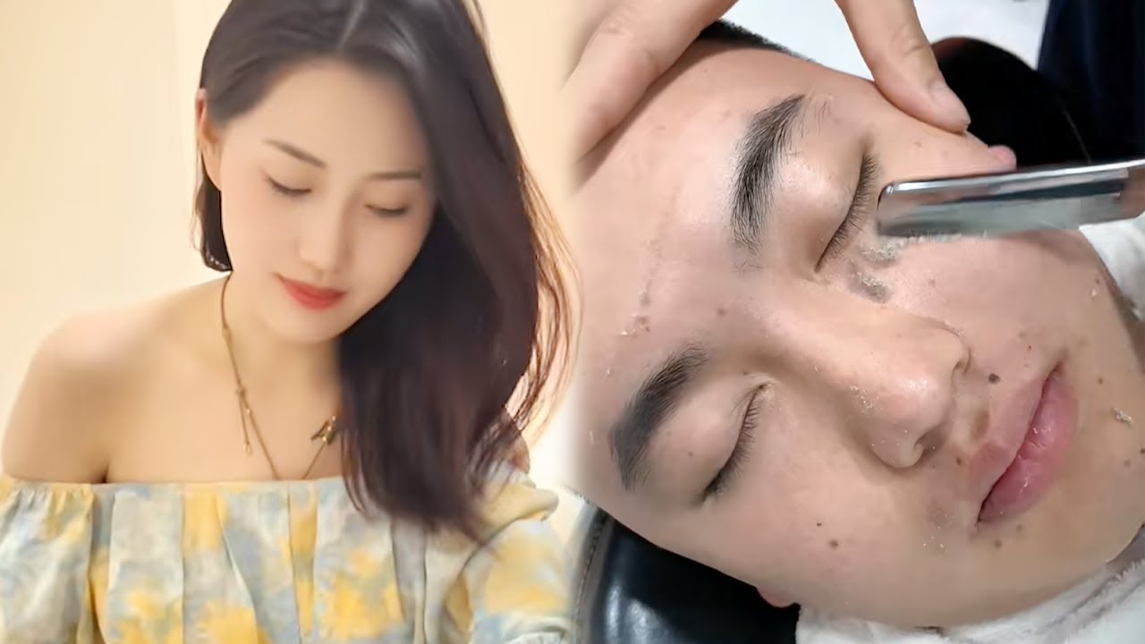 💈ASMR | Remove a lot of dead skin from a man's face. 🪒So insane shave.