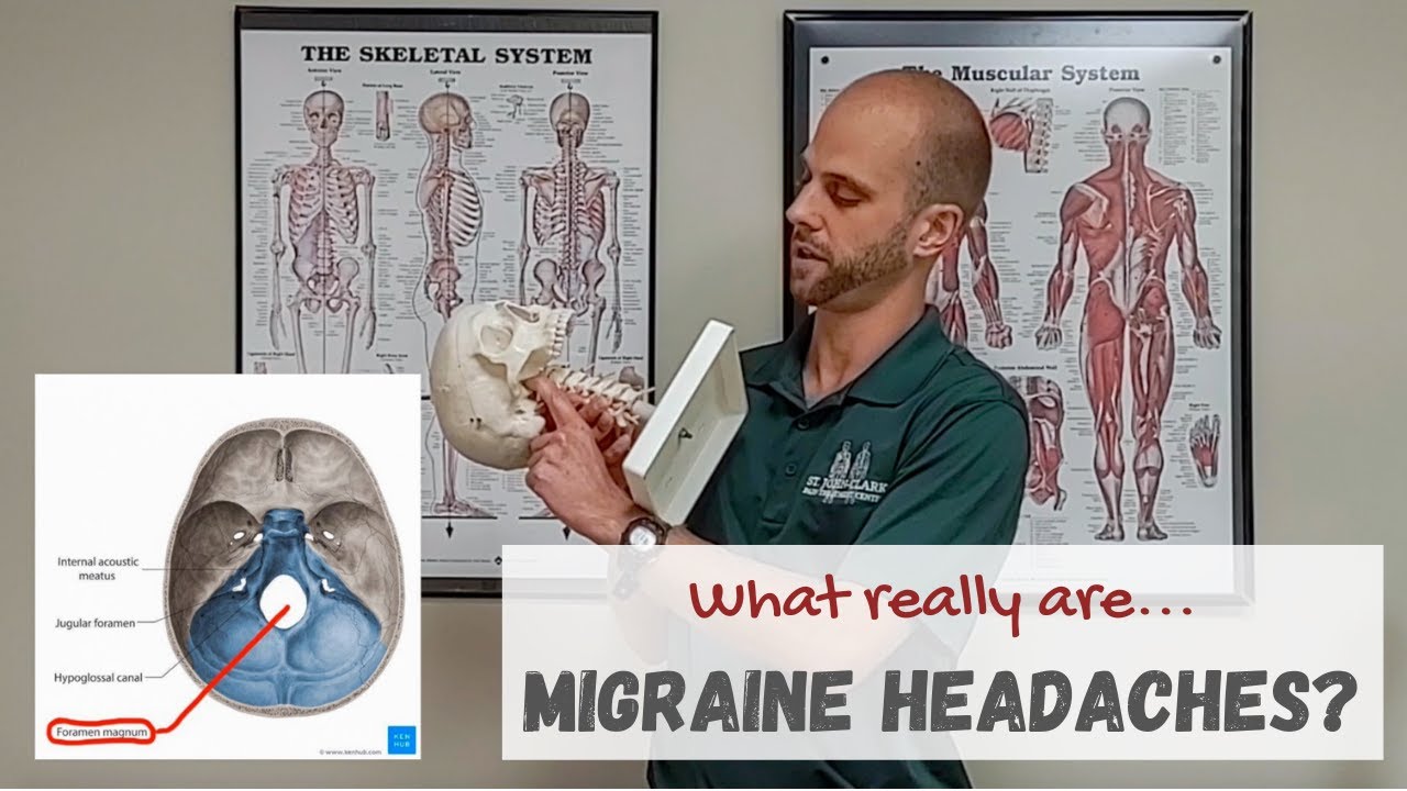 Migraine Headaches? What REALLY are they?