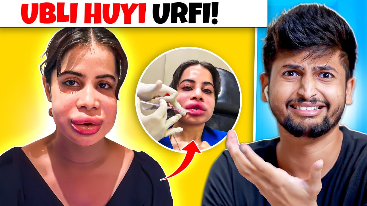 URFI JAVED LIP FILLERS GONE WRONG 😨
