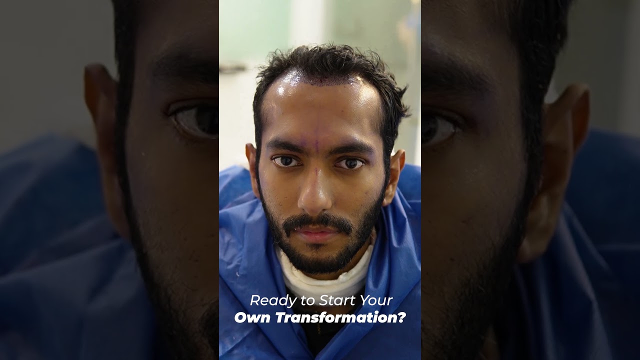 Today's procedure at Hair Club: FUE Hair Transplant with DHI technology.