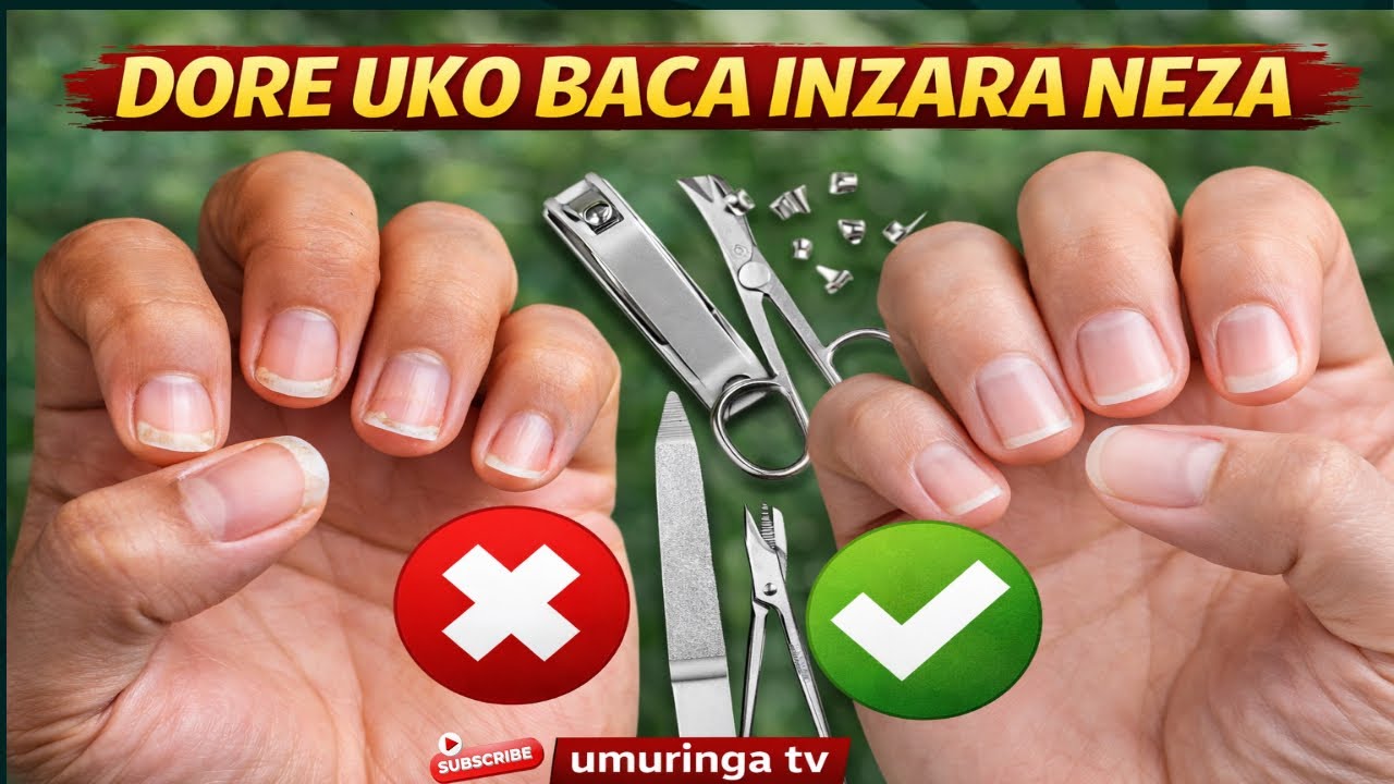 DORE UKO WAGIRA INZARA NZIZA  NUBURYO BWIZA BWO KUZICA BITAZANGIZA