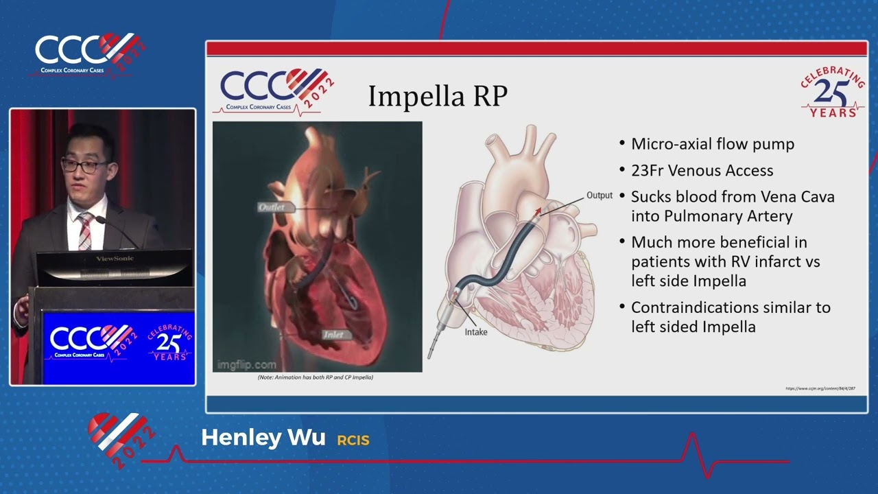 Mechanical Circulatory Support Devices in the Cath Lab - Henley Wu, RCIS