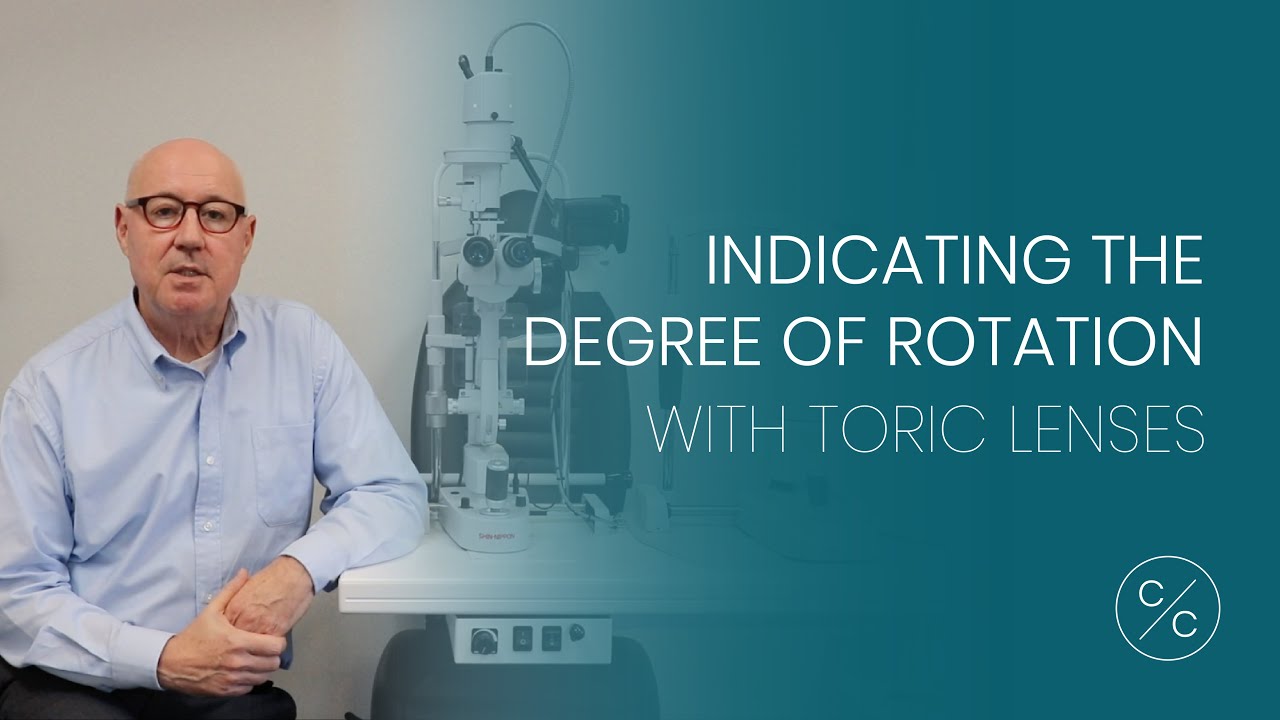 Indicating the Degree of Rotation with Toric Lenses | Contacts with Conway