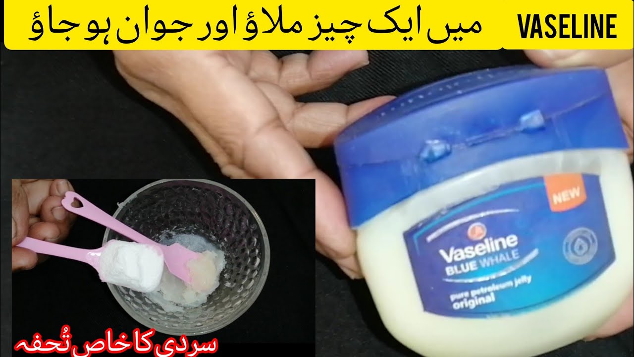 Thing with VASELINE |Say Goodbye to Dry, Cracked Winter Skin |Vaseline Hacks 2025