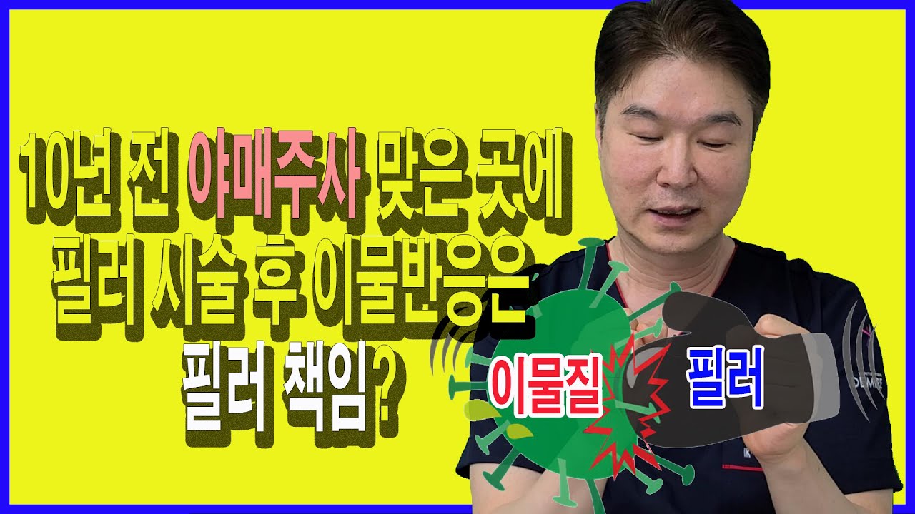 【CN SUB】이물질주입 (야매주사) 후 다시 그 부위에 필러를 맞고 이물반응이 일어났어요. 문제 없던 이물질에 필러시술 한 것  때문에 문제가 일어난 거 아닌가요?