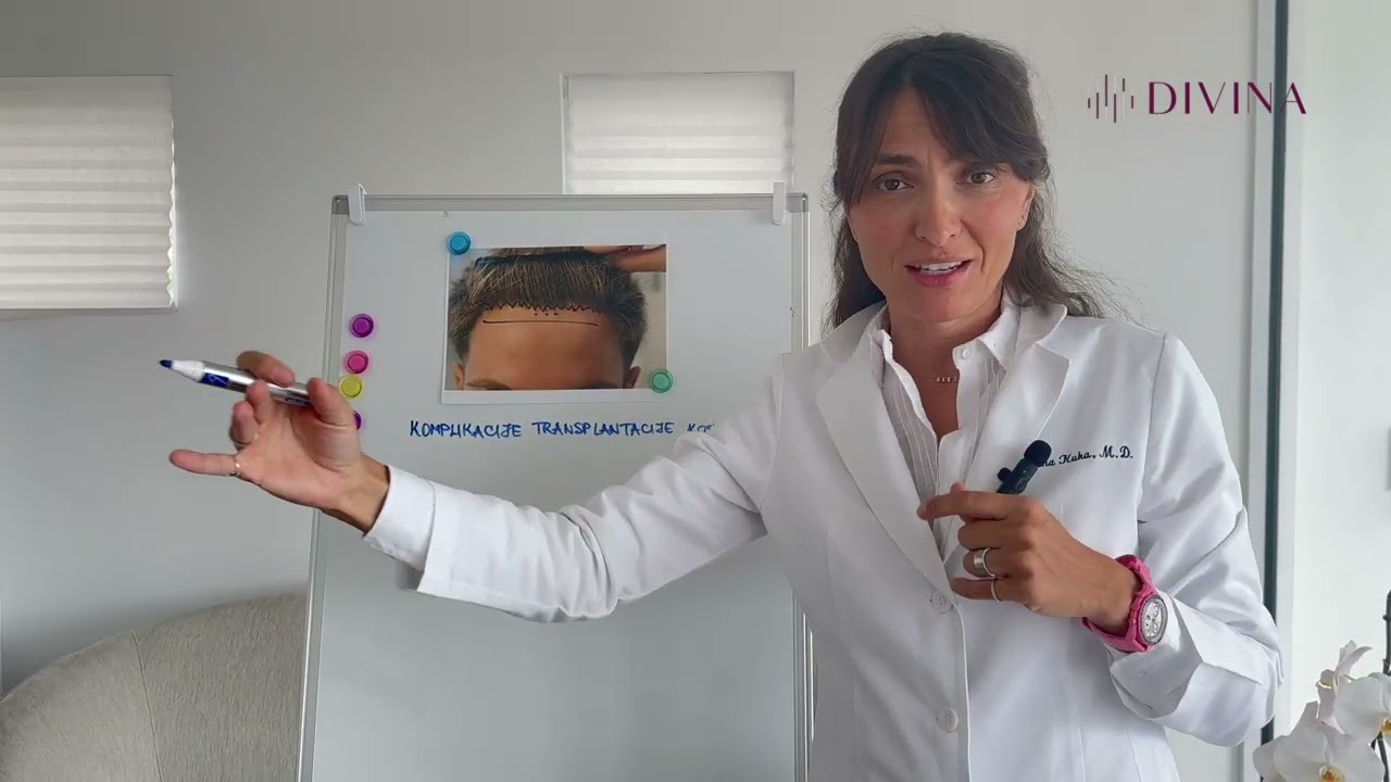 Neprirodan rezultat transplantacije kose - dr Gorana Kuka Epstein