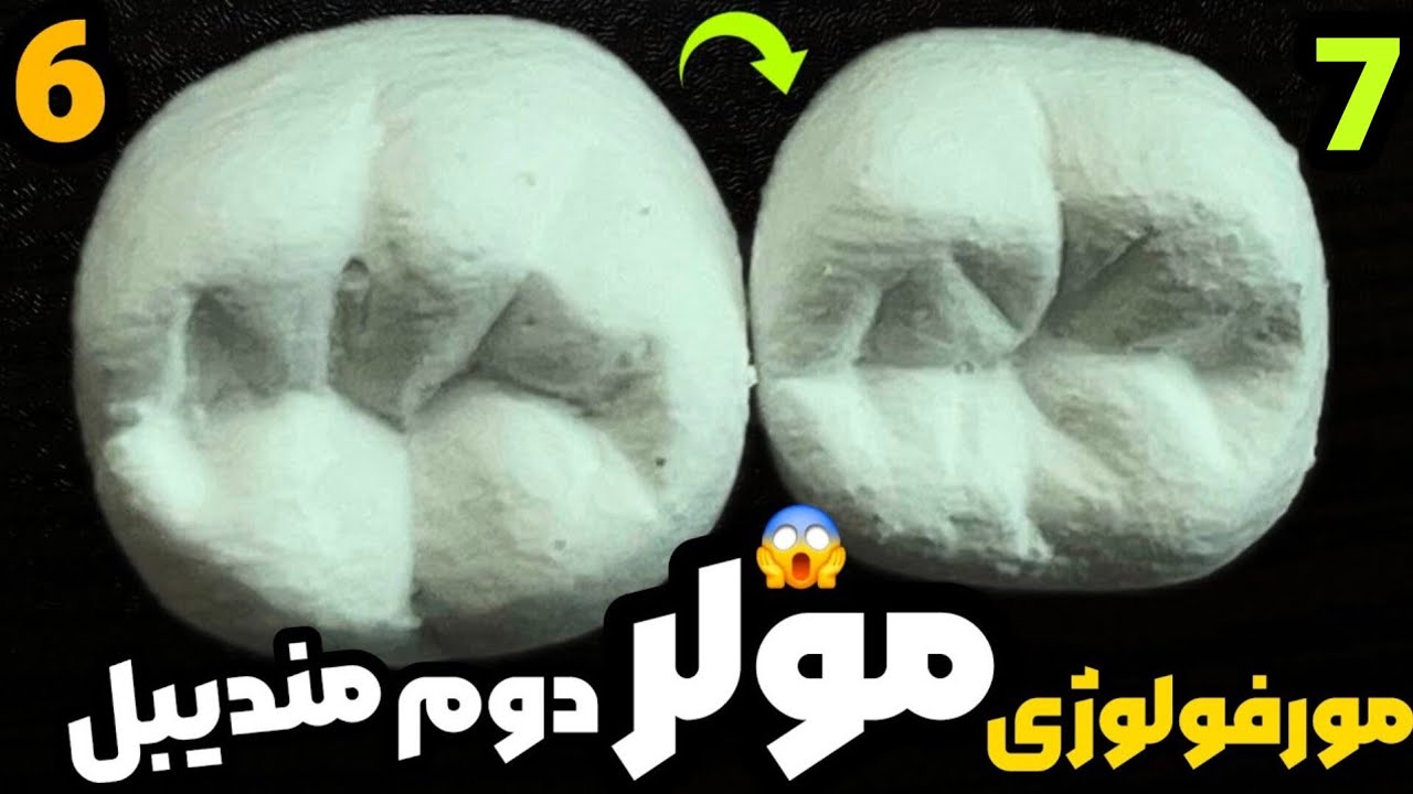 آناتومی دندان مولر دوم پایین|مورفولوژی دندان مولر دوم پایین carving of mandibular second molar