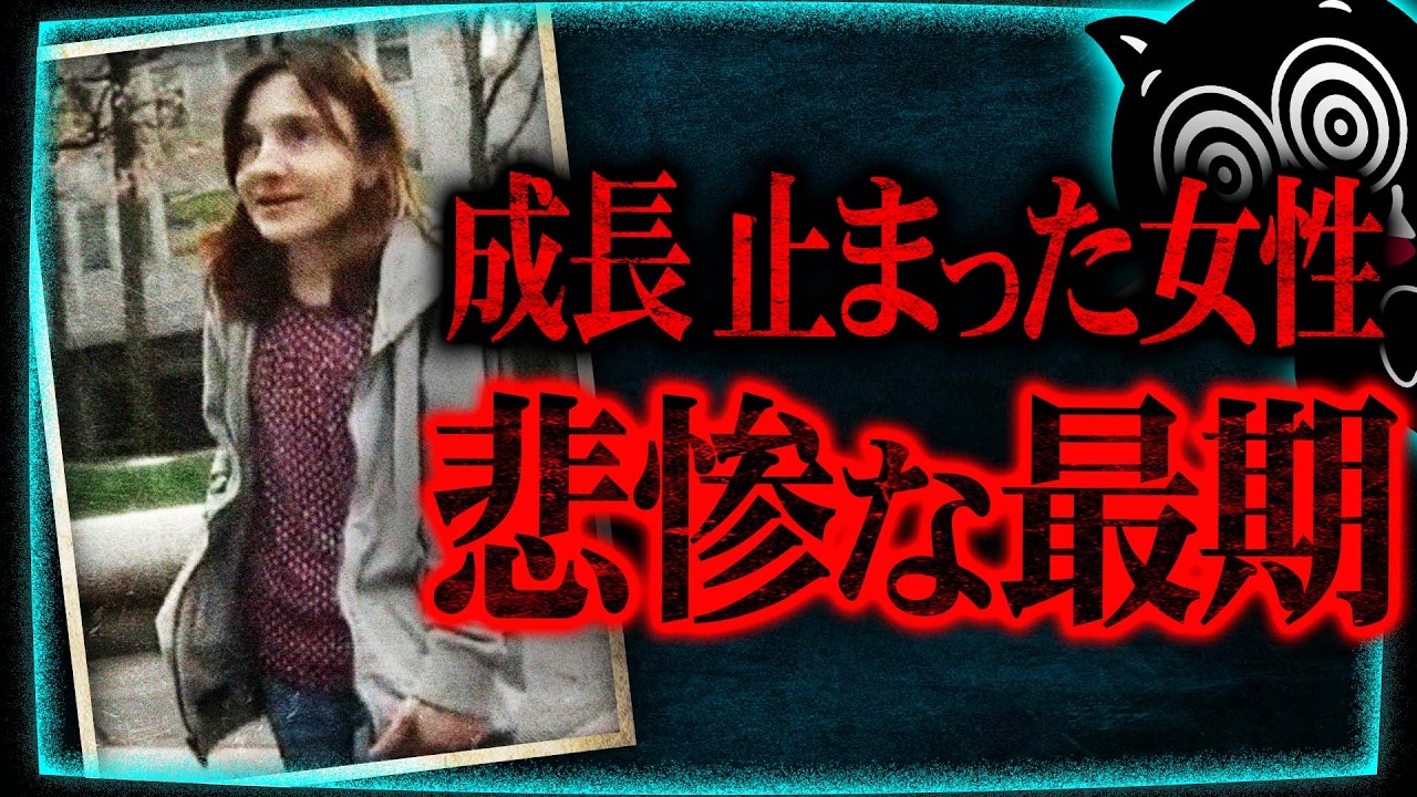 【閲覧注意】成長止まった難病女性の死体が道路標識の括りつけられる怪事件