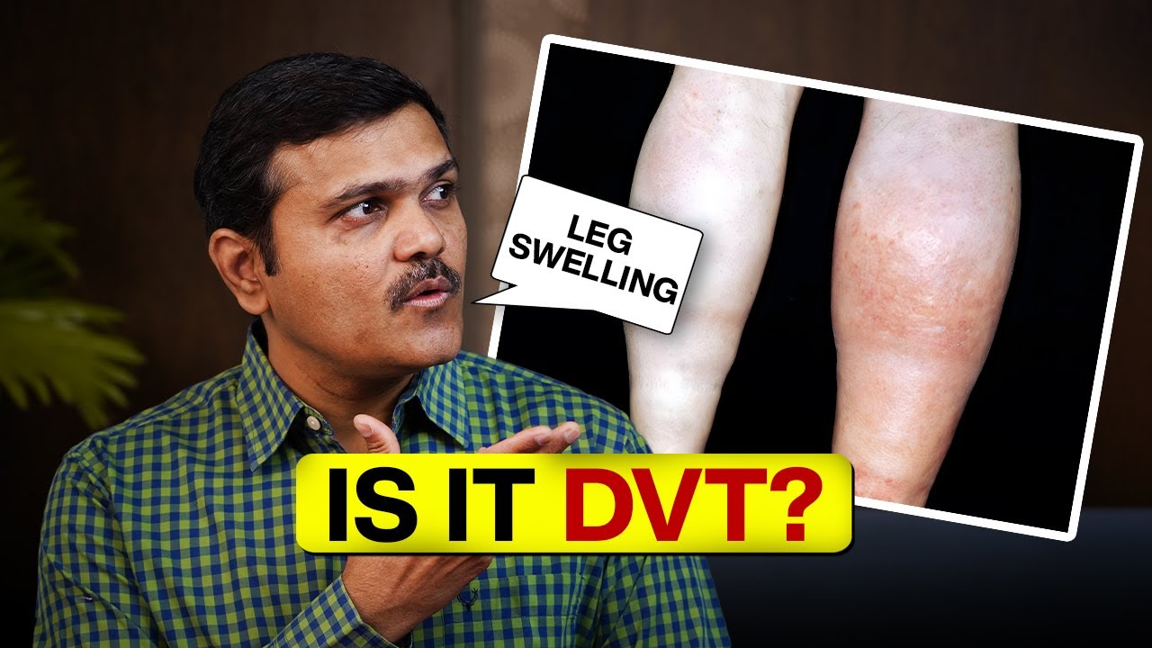 Stay Alert: Common Signs of Deep Vein Thrombosis (DVT)
