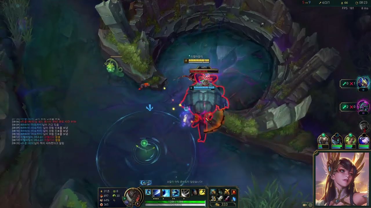 Irelking Vod I Master 125LP
