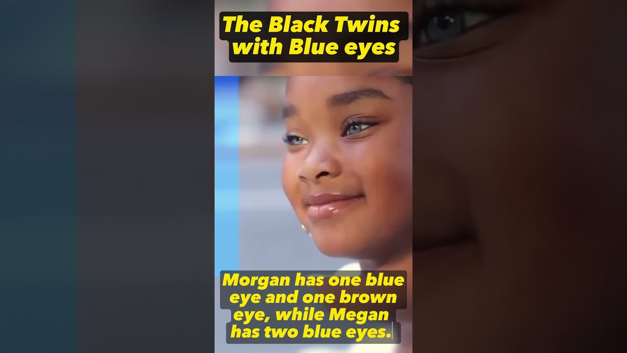 Black Twins with Blue Eyes #africa #afro #black