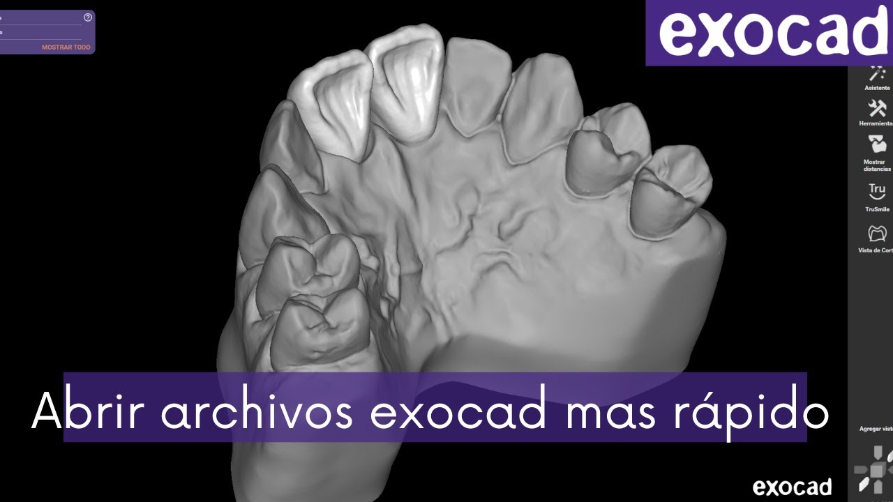 💥Abrir archivos exocad de forma más RÁPIDA💥