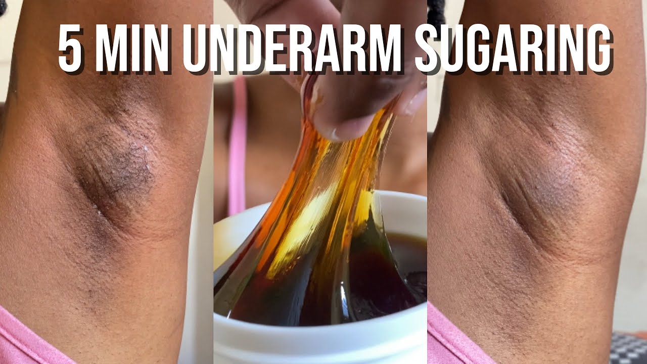 DIY | Sugar Waxing My Underarms At Home 🍯