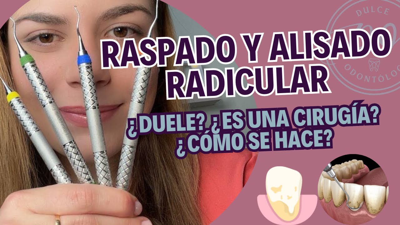 Raspado y alisado radicular PASO A PASO en 2026 🦷✅