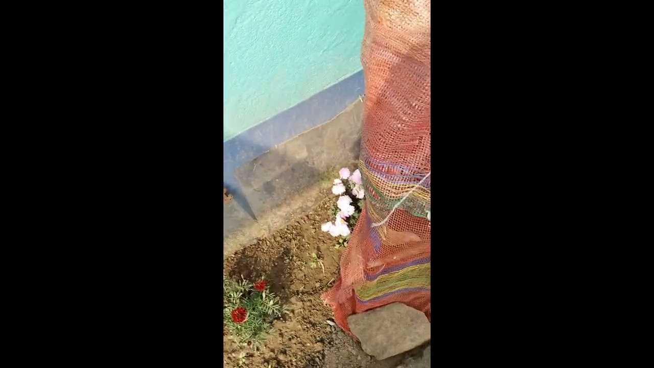 দুদুন এর অপারেশন কমপ্লিট দুদুন এখন সুস্থ আছে ভালো আছে 🙏🥰☺️🌷