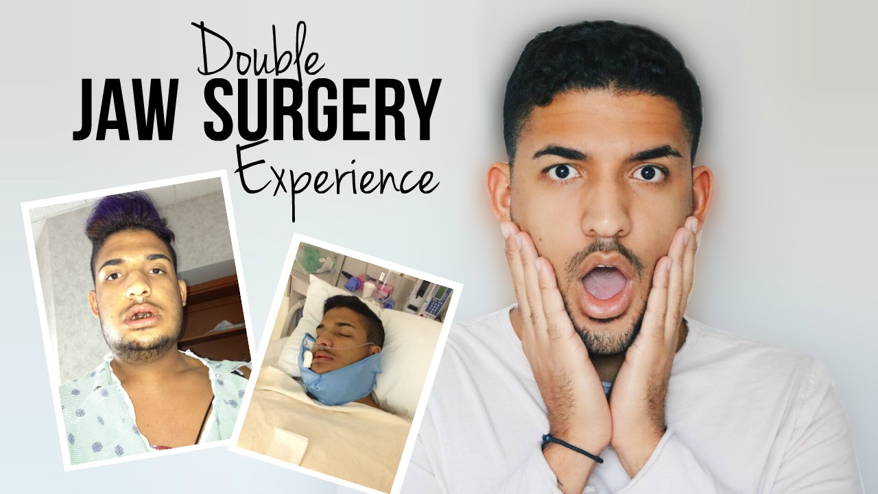 STORY TIME: MY DOUBLE JAW SURGERY EXPERIENCE | DemTheCeleb