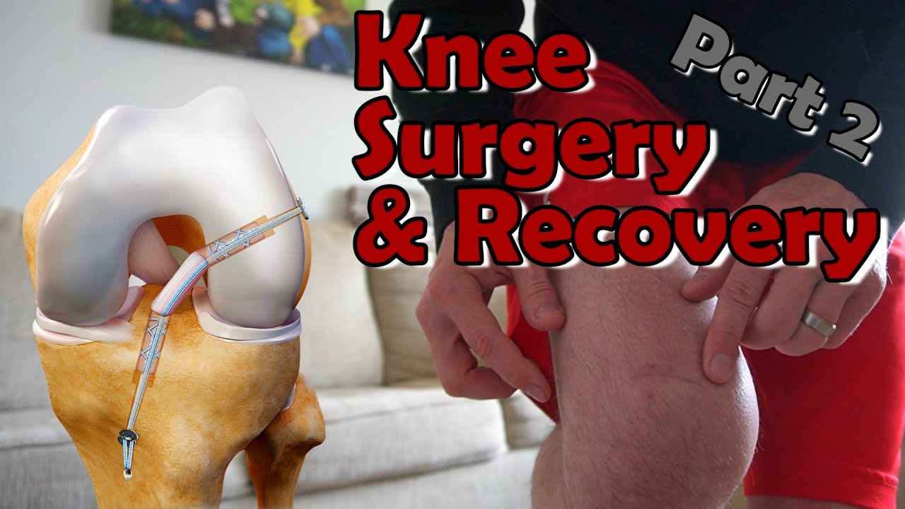 Climber Recovering from Knee Surgery - Part 2