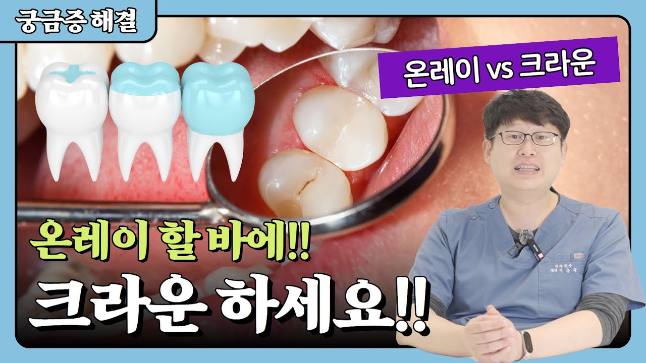 이를 때웠는데도 이가 계속 시린 이유 | 인레이, 온레이, 오버레이, 크라운