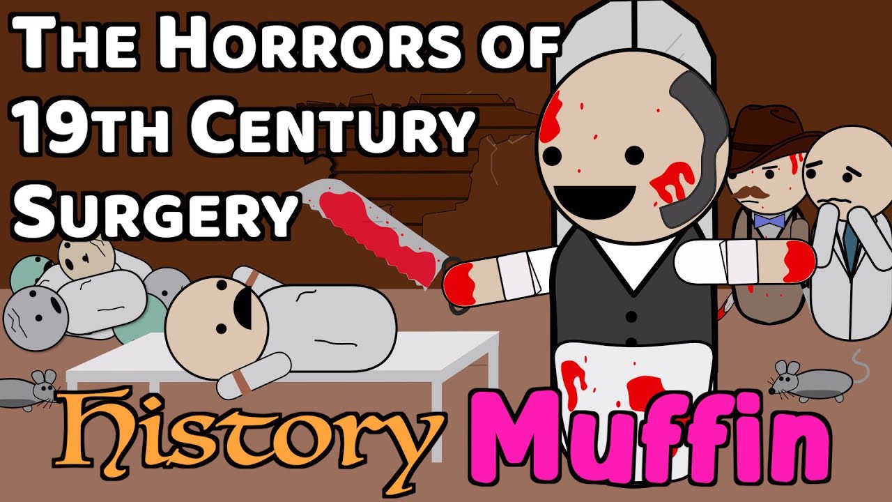 Robert Liston and the 300% Mortality Surgery - History Muffin