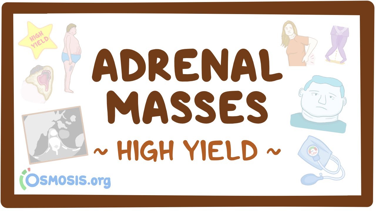 Adrenal masses: Pathology review