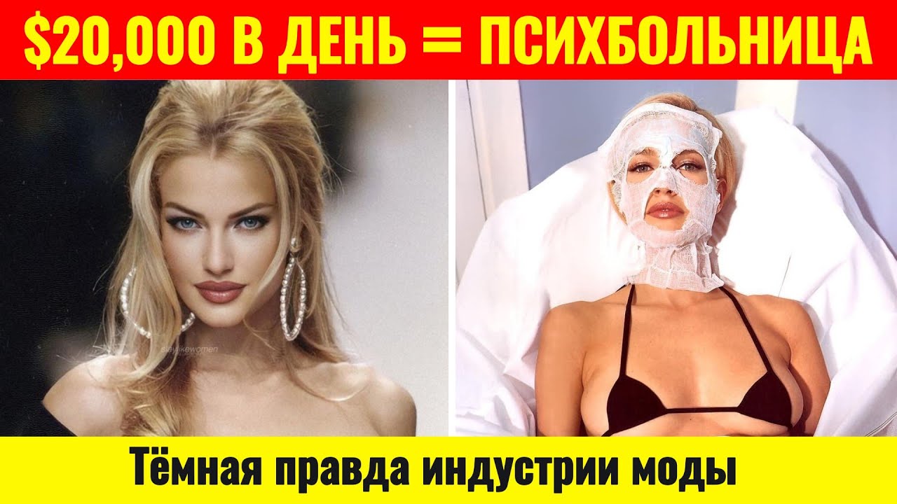 Карен Мюлдер: Супермодель, которую заставили замолчать | Она обвинила индустрию в насилии и исчезла