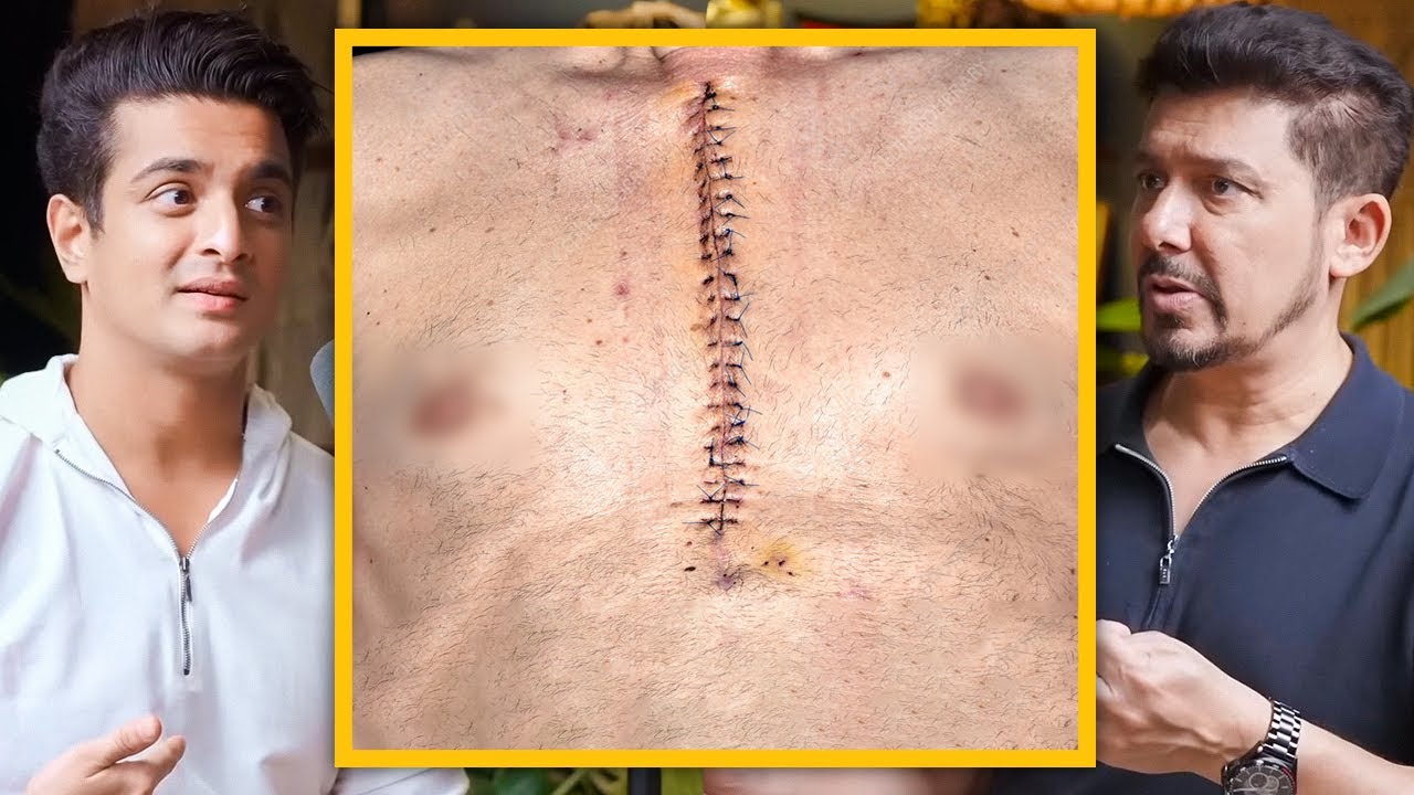 Heart Surgery EXPLAINED - Stents, Bypass, and Recovery - Doctor Nene