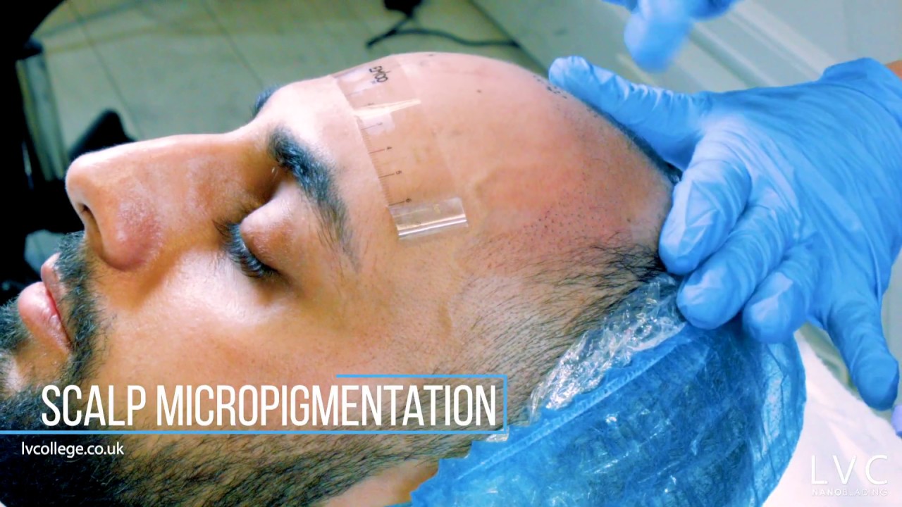 SMP - Scalp Micropigmentation Courses in London by LV College