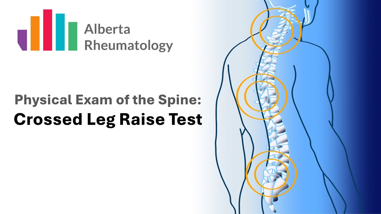 Rheumatology BACK exam: Cross Straight Leg Test