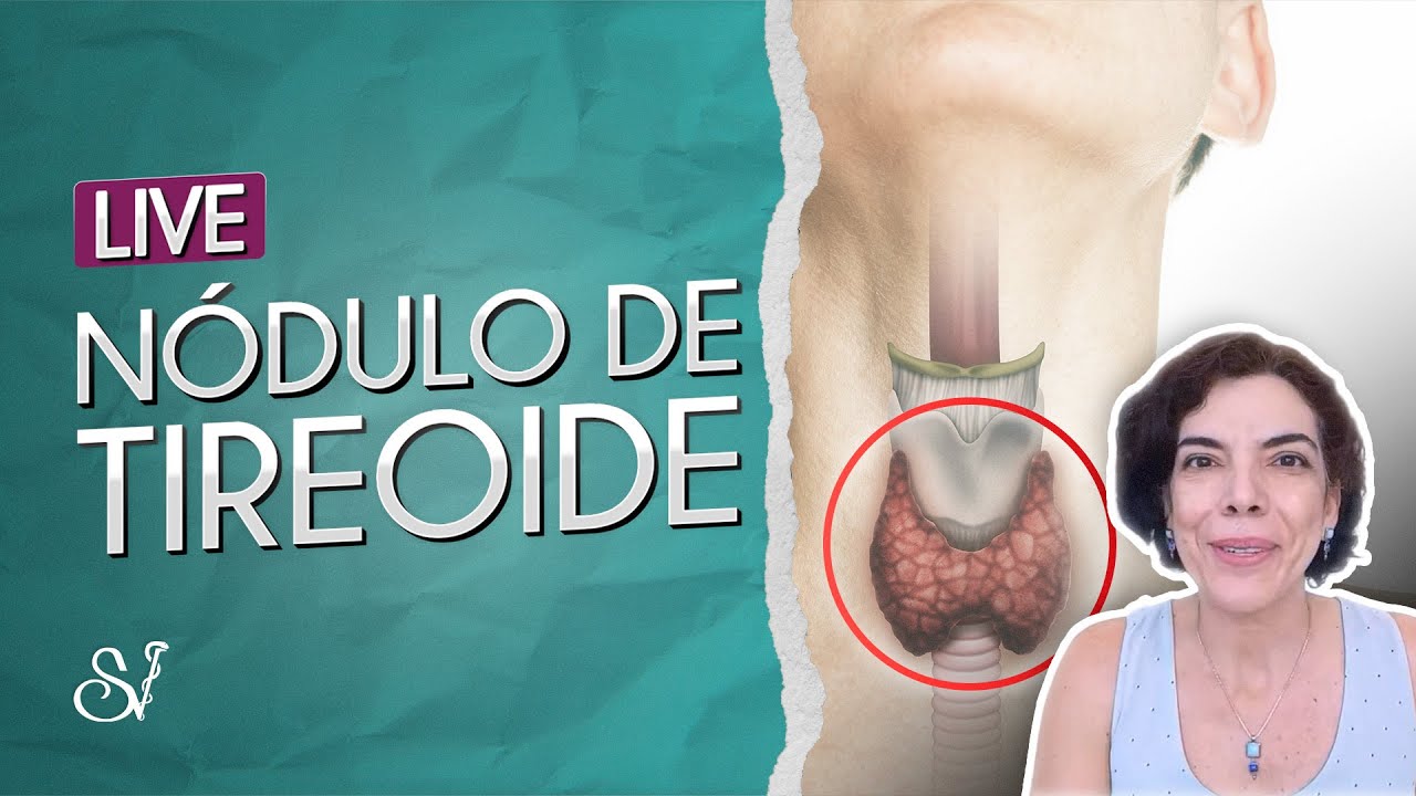 Live nódulo de tireoide