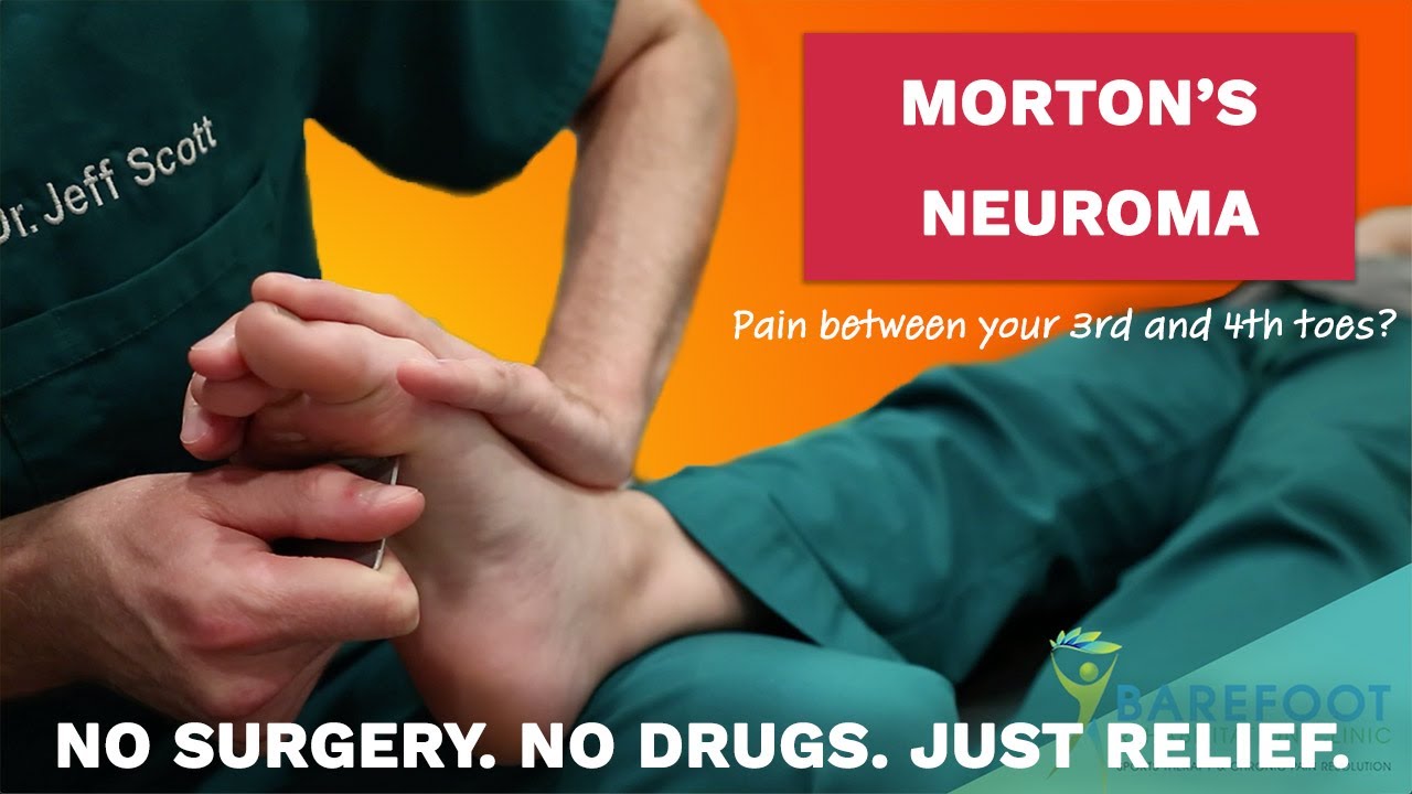 Morton&rsquo;s Neuroma: The Non-Surgical Treatment