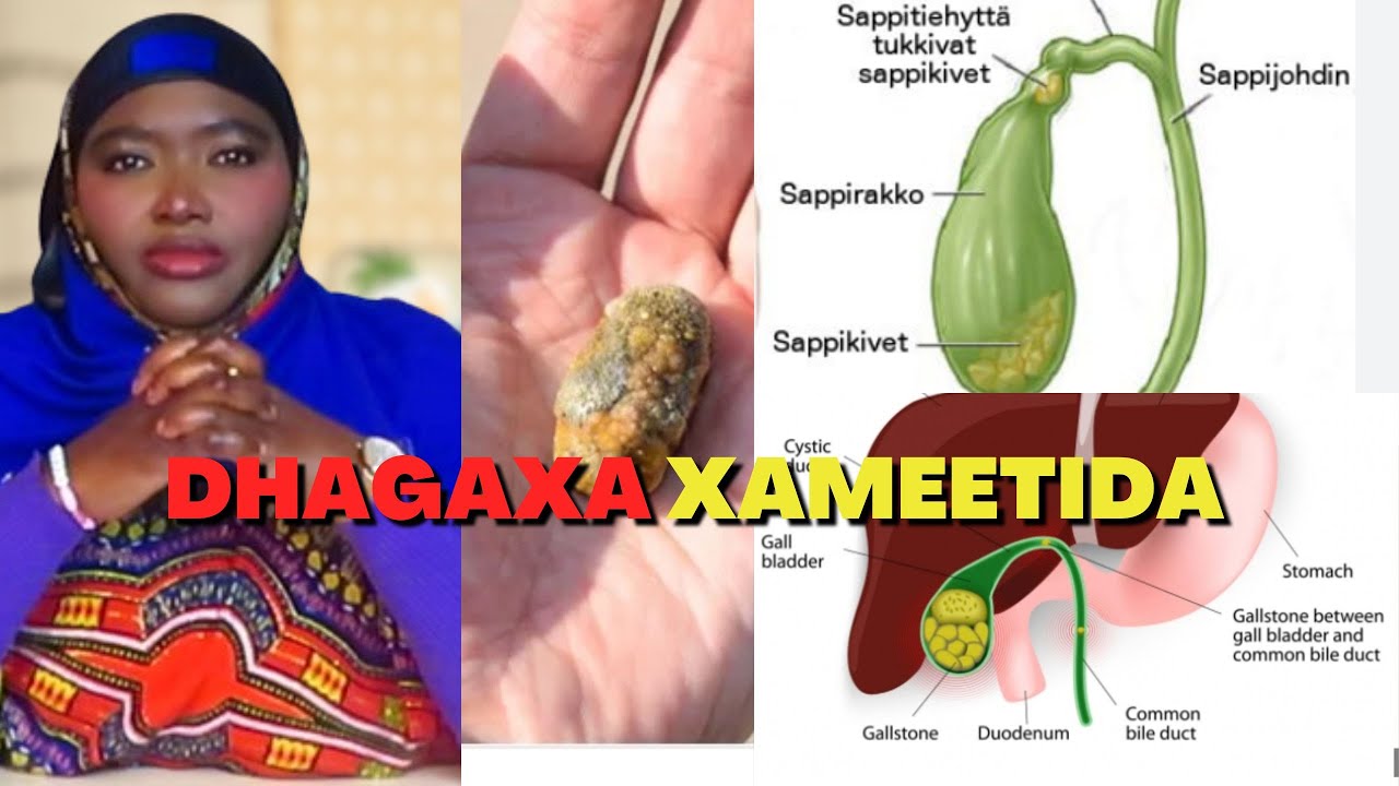 SABABAHA KEENA DHAGAXA XAMEETIDA IYO ASTAAMAHA LAGU GARTO!