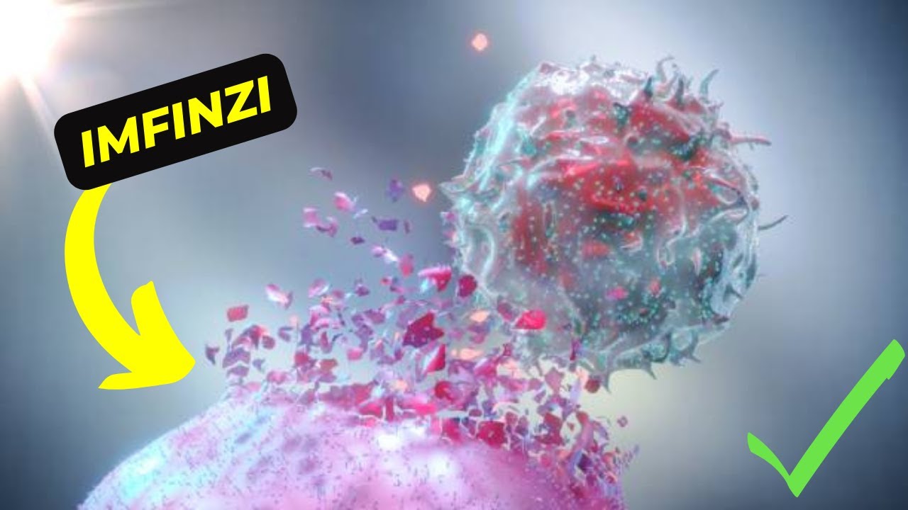 Imfinzi Uses: Guide to Understanding the Many Benefits of this Breakthrough Immunotherapy
