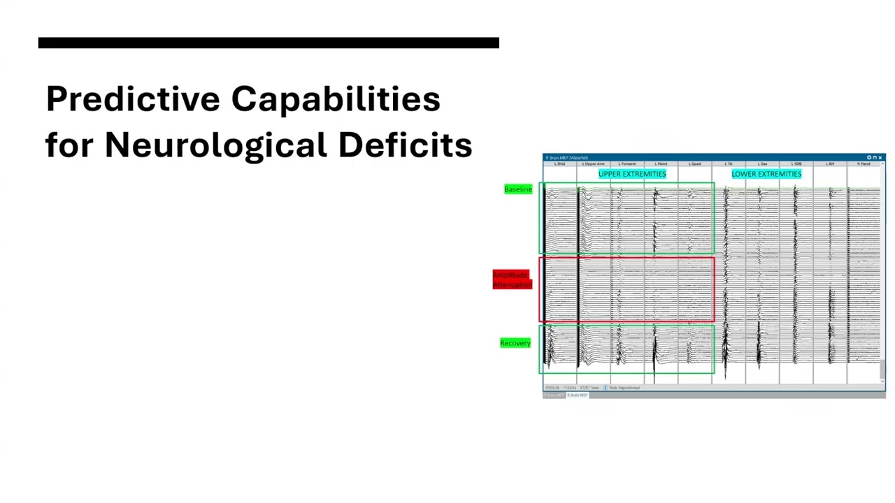 7/15/2025 Neuro Monitoring in Surgery
